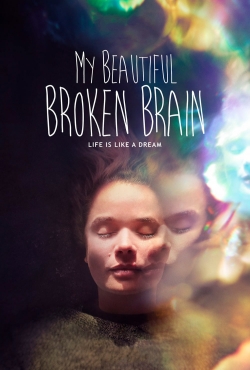 My Beautiful Broken Brain full